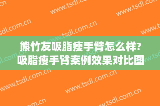 熊竹友吸脂瘦手臂怎么样?吸脂瘦手臂案例效果对比图_蚌埠医学院第一附属医院