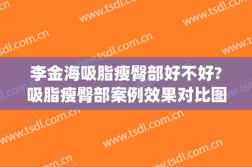 李金海吸脂瘦臀部好不好?吸脂瘦臀部案例效果对比图_好大夫工作室(臀部吸脂整形)