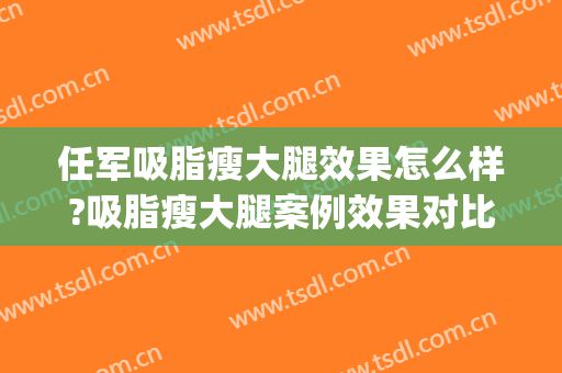 任军吸脂瘦大腿效果怎么样?吸脂瘦大腿案例效果对比图_武汉市第三医院