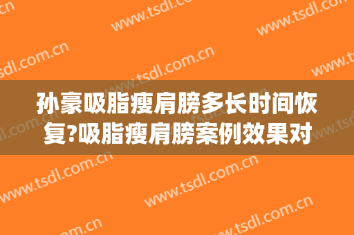 孙豪吸脂瘦肩膀多长时间恢复?吸脂瘦肩膀案例效果对比图_杭州整形医院