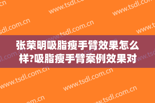 张荣明吸脂瘦手臂效果怎么样?吸脂瘦手臂案例效果对比图_锦州医科大学附属第三医院