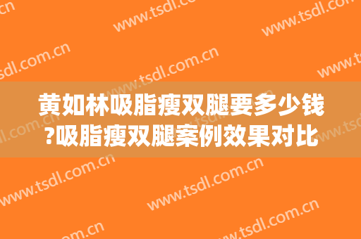 黄如林吸脂瘦双腿要多少钱?吸脂瘦双腿案例效果对比图_上海交通大学医学院附属第九人民医院