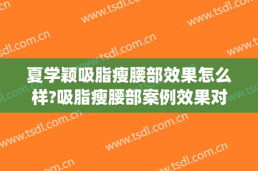 夏学颖吸脂瘦腰部效果怎么样?吸脂瘦腰部案例效果对比图_广东省妇幼保健院