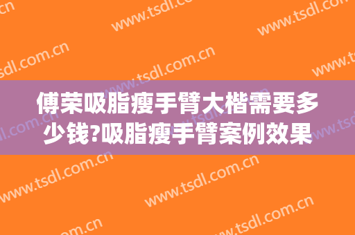 傅荣吸脂瘦手臂大楷需要多少钱?吸脂瘦手臂案例效果对比图_四川省医学科学院·四川省人民医院