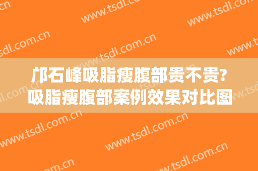 邝石峰吸脂瘦腹部贵不贵?吸脂瘦腹部案例效果对比图_广东省人民医院