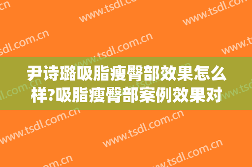 尹诗璐吸脂瘦臀部效果怎么样?吸脂瘦臀部案例效果对比图_北京大学第三医院