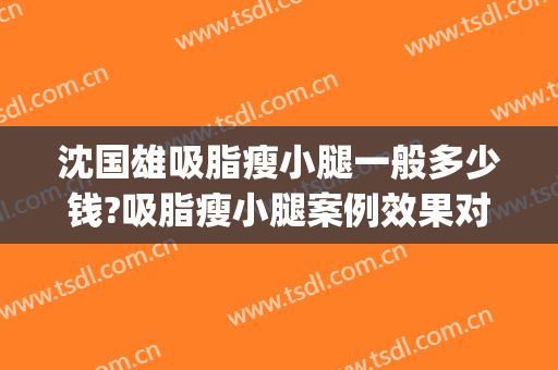 沈国雄吸脂瘦小腿一般多少钱?吸脂瘦小腿案例效果对比图_上海伯思立医疗美容门诊部