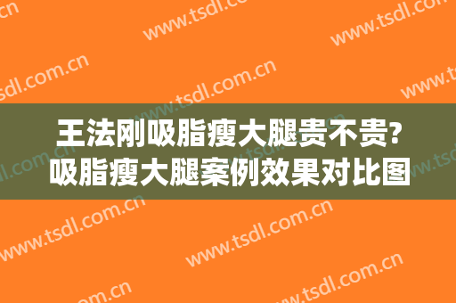 王法刚吸脂瘦大腿贵不贵?吸脂瘦大腿案例效果对比图_山东省立医院(吸脂减大腿)
