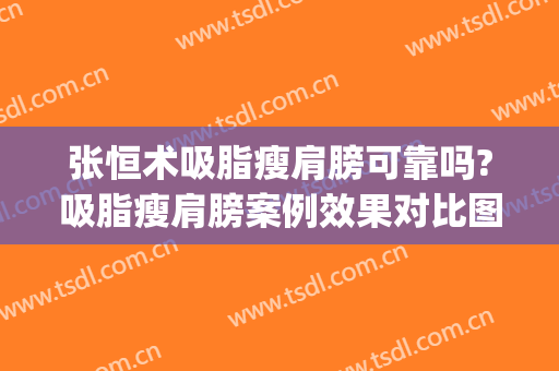 张恒术吸脂瘦肩膀可靠吗?吸脂瘦肩膀案例效果对比图_重庆医科大学附属第一医院