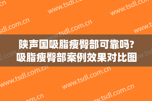 陕声国吸脂瘦臀部可靠吗?吸脂瘦臀部案例效果对比图_武汉大学人民医院