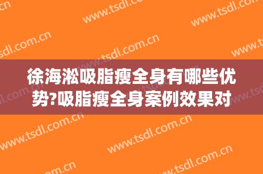 徐海淞吸脂瘦全身有哪些优势?吸脂瘦全身案例效果对比图_上海交通大学医学院附属第九人民医院