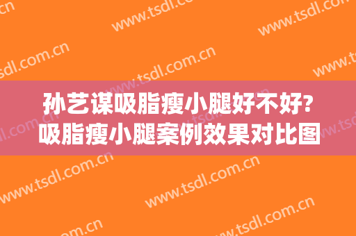 孙艺谋吸脂瘦小腿好不好?吸脂瘦小腿案例效果对比图_北京大学第三医院