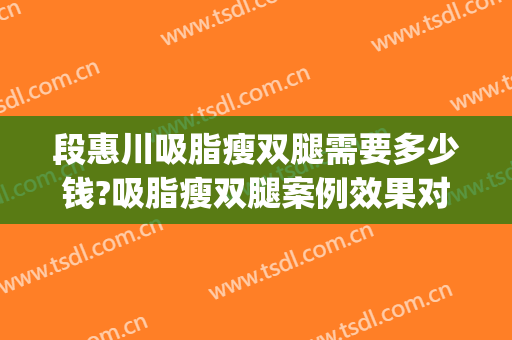 段惠川吸脂瘦双腿需要多少钱?吸脂瘦双腿案例效果对比图_上海交通大学医学院附属第九人民医院