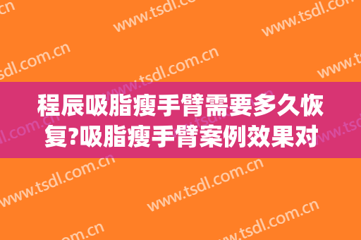 程辰吸脂瘦手臂需要多久恢复?吸脂瘦手臂案例效果对比图_上海交通大学医学院附属第九人民医院