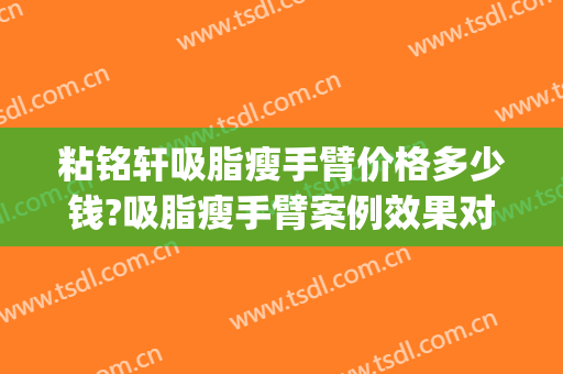 粘铭轩吸脂瘦手臂价格多少钱?吸脂瘦手臂案例效果对比图_北京大学深圳医院
