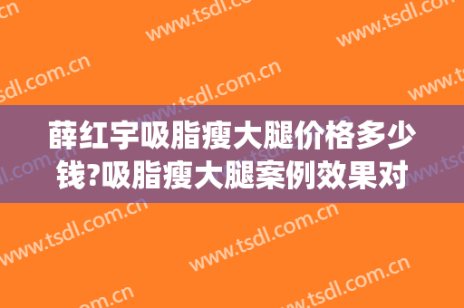 薛红宇吸脂瘦大腿价格多少钱?吸脂瘦大腿案例效果对比图_北京大学第三医院