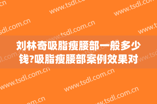 刘林奇吸脂瘦腰部一般多少钱?吸脂瘦腰部案例效果对比图_陆军军医大学第一附属医院(重庆西南医院)