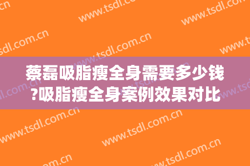 蔡磊吸脂瘦全身需要多少钱?吸脂瘦全身案例效果对比图_中国医学科学院整形外科医院