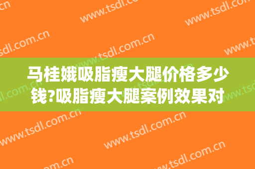 马桂娥吸脂瘦大腿价格多少钱?吸脂瘦大腿案例效果对比图_中国医学科学院整形外科医院