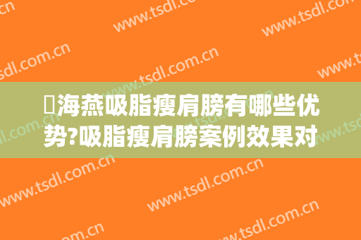 侴海燕吸脂瘦肩膀有哪些优势?吸脂瘦肩膀案例效果对比图_河南省人民医院