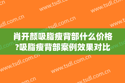 肖开颜吸脂瘦背部什么价格?吸脂瘦背部案例效果对比图_上海交通大学医学院附属第九人民医院