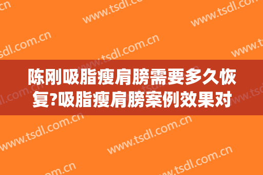 陈刚吸脂瘦肩膀需要多久恢复?吸脂瘦肩膀案例效果对比图_江苏省中医院