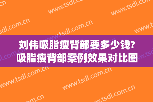 刘伟吸脂瘦背部要多少钱?吸脂瘦背部案例效果对比图_中国医学科学院整形外科医院