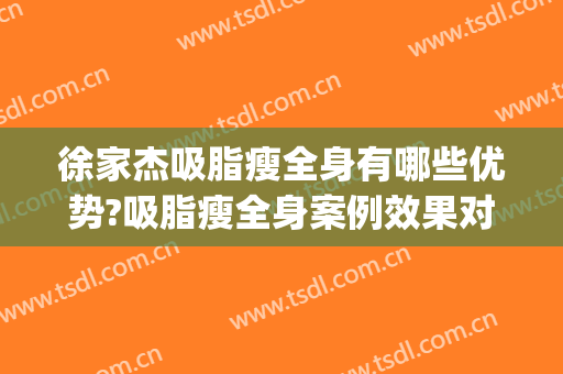徐家杰吸脂瘦全身有哪些优势?吸脂瘦全身案例效果对比图_中国医学科学院整形外科医院