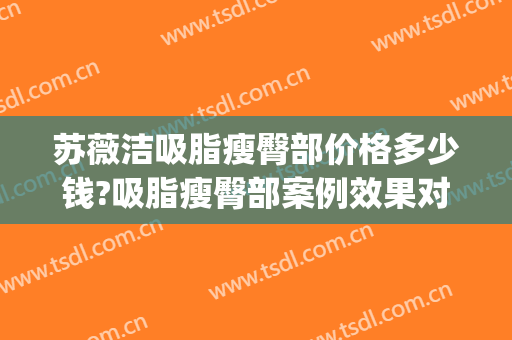 苏薇洁吸脂瘦臀部价格多少钱?吸脂瘦臀部案例效果对比图_上海交通大学医学院附属第九人民医院