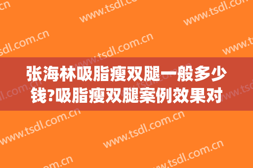张海林吸脂瘦双腿一般多少钱?吸脂瘦双腿案例效果对比图_中国医学科学院北京协和医院