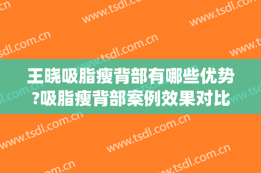 王晓吸脂瘦背部有哪些优势?吸脂瘦背部案例效果对比图_河北省人民医院