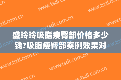 盛玲玲吸脂瘦臀部价格多少钱?吸脂瘦臀部案例效果对比图_上海交通大学医学院附属第九人民医院