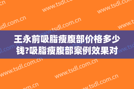 王永前吸脂瘦腹部价格多少钱?吸脂瘦腹部案例效果对比图_中国医学科学院整形外科医院