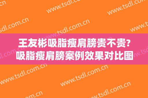 王友彬吸脂瘦肩膀贵不贵?吸脂瘦肩膀案例效果对比图_中国医学科学院北京协和医院