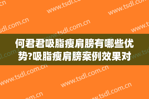 何君君吸脂瘦肩膀有哪些优势?吸脂瘦肩膀案例效果对比图_北京大学深圳医院
