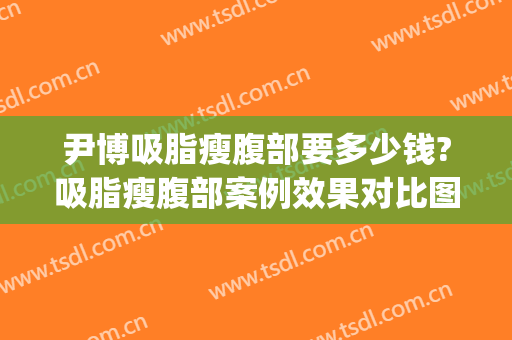 尹博吸脂瘦腹部要多少钱?吸脂瘦腹部案例效果对比图_中国医学科学院整形外科医院