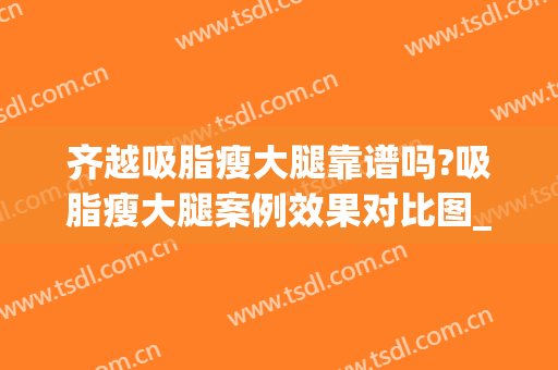 齐越吸脂瘦大腿靠谱吗?吸脂瘦大腿案例效果对比图_中国医学科学院整形外科医院