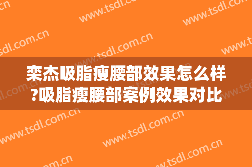 栾杰吸脂瘦腰部效果怎么样?吸脂瘦腰部案例效果对比图_中国医学科学院整形外科医院