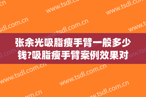 张余光吸脂瘦手臂一般多少钱?吸脂瘦手臂案例效果对比图_上海交通大学医学院附属第九人民医院