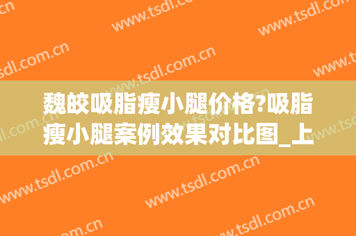 魏皎吸脂瘦小腿价格?吸脂瘦小腿案例效果对比图_上海交通大学医学院附属第九人民医院