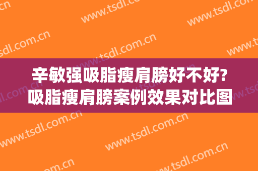 辛敏强吸脂瘦肩膀好不好?吸脂瘦肩膀案例效果对比图_中国医学科学院整形外科医院