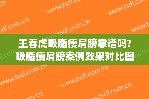 王春虎吸脂瘦肩膀靠谱吗?吸脂瘦肩膀案例效果对比图_中国医学科学院整形外科医院