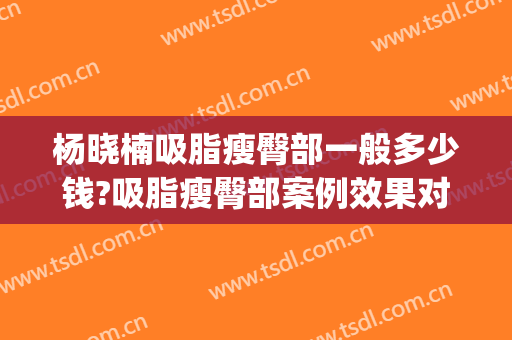杨晓楠吸脂瘦臀部一般多少钱?吸脂瘦臀部案例效果对比图_中国医学科学院整形外科医院