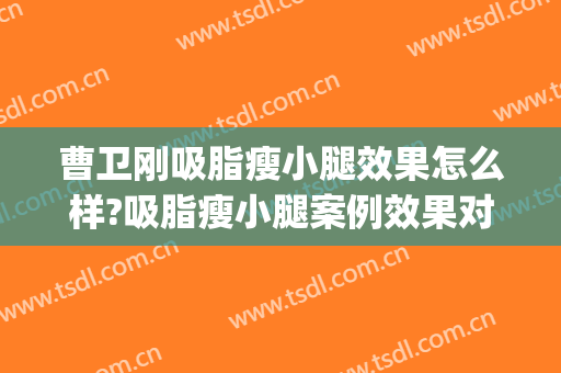 曹卫刚吸脂瘦小腿效果怎么样?吸脂瘦小腿案例效果对比图_上海交通大学医学院附属第九人民医院