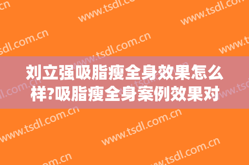 刘立强吸脂瘦全身效果怎么样?吸脂瘦全身案例效果对比图_中国医学科学院整形外科医院