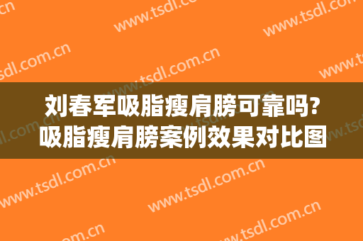 刘春军吸脂瘦肩膀可靠吗?吸脂瘦肩膀案例效果对比图_中国医学科学院整形外科医院