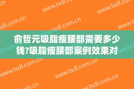 俞哲元吸脂瘦腰部需要多少钱?吸脂瘦腰部案例效果对比图_上海交通大学医学院附属第九人民医院