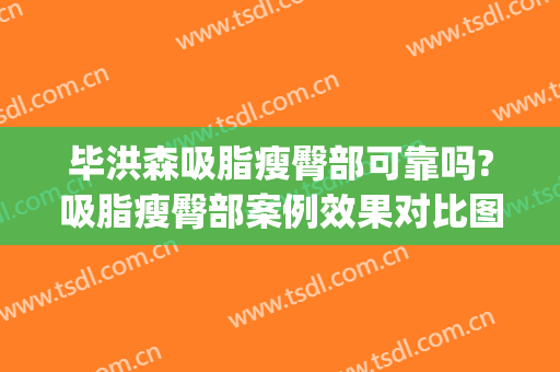 毕洪森吸脂瘦臀部可靠吗?吸脂瘦臀部案例效果对比图_北京大学第三医院