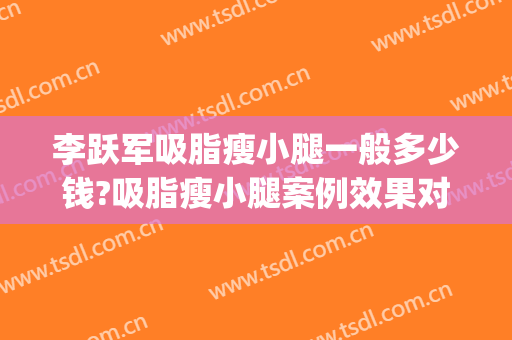 李跃军吸脂瘦小腿一般多少钱?吸脂瘦小腿案例效果对比图_空军军医大学唐都医院