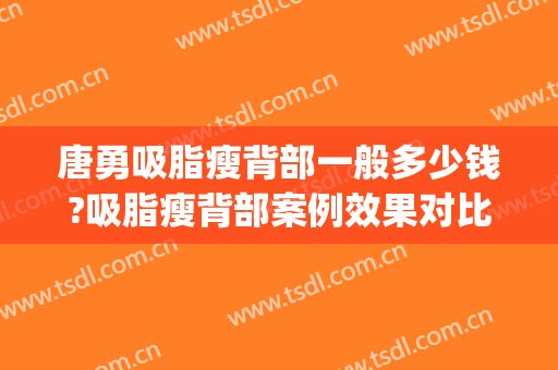 唐勇吸脂瘦背部一般多少钱?吸脂瘦背部案例效果对比图_中国医学科学院整形外科医院